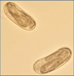 Soybean cyst nematode eggs
