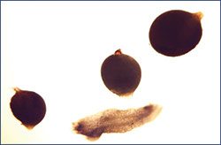 female soybean cyst nematodes