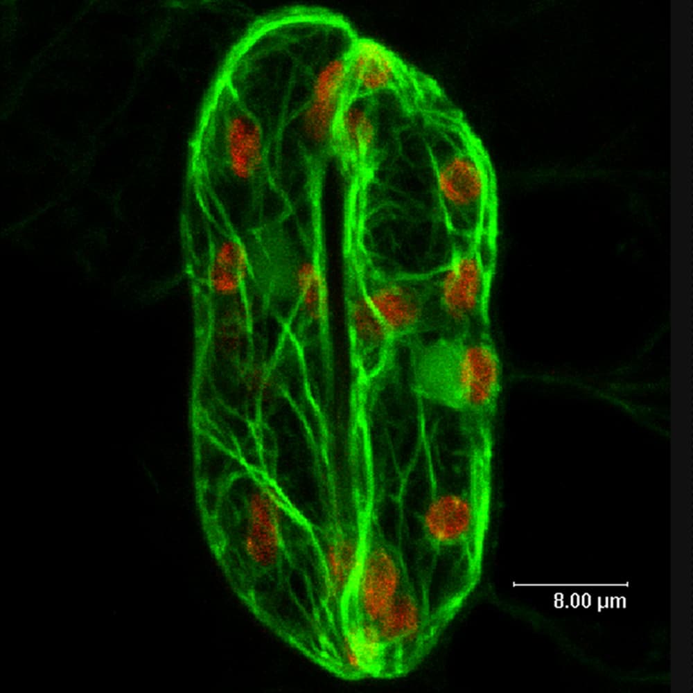 Stoma Credit: Smita Kurup/Rothamsted Research