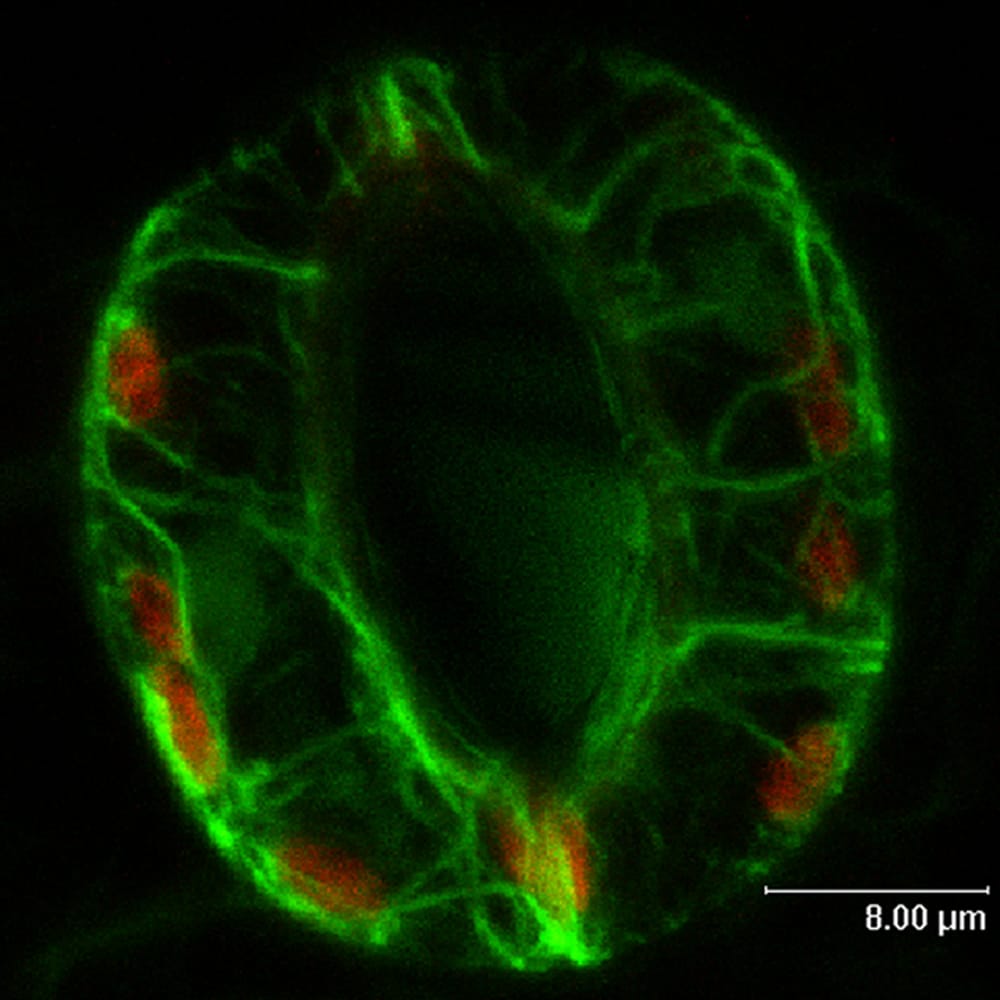 Stoma Credit: Smita Kurup/Rothamsted Research