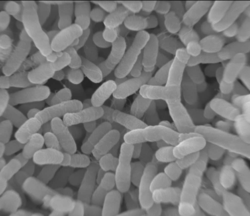 Inside the DNA Switch That Alters a Biotech Bacterium’s Strength